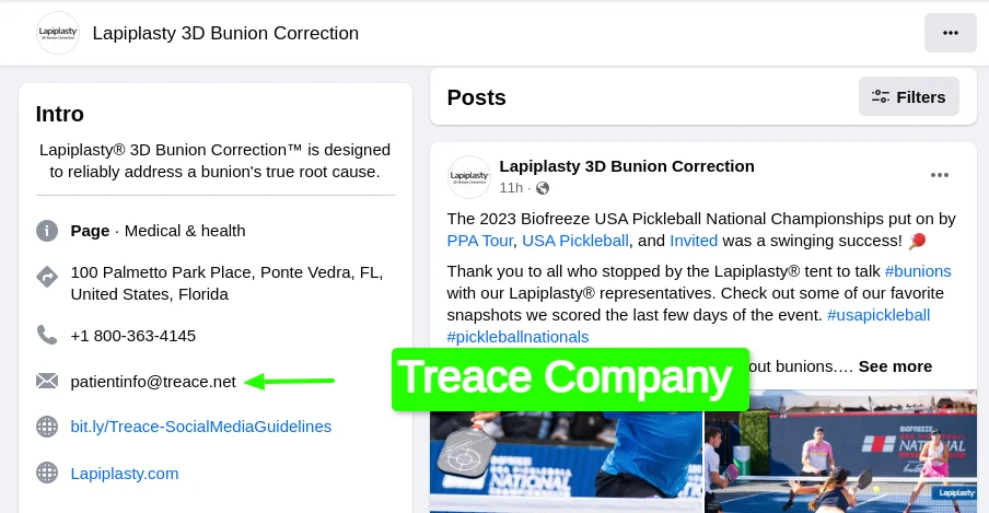 Treace Company